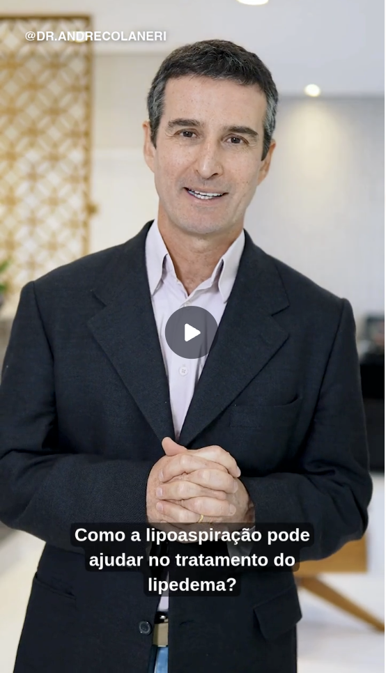 Capa do vídeo Tratamento cirúrgico do lipedema — parte 1 — Dr. André Colaneri, lipedema em Uberlândia MG