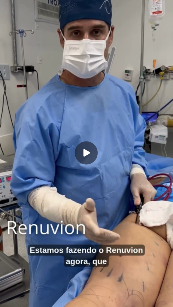 Capa do vídeo Renuvion — Dr. André Colaneri, lipedema em Uberlândia MG