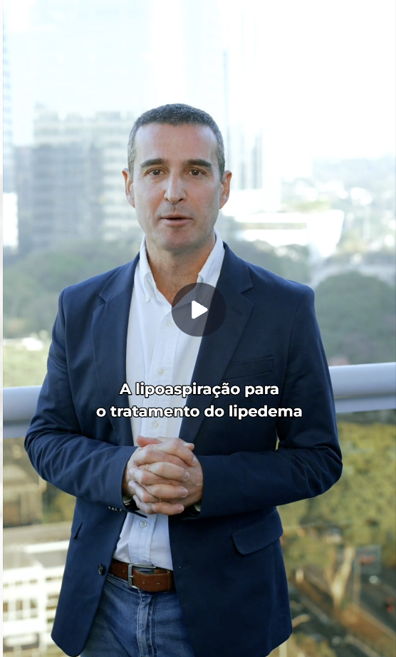 Capa do vídeo Tratamento cirúrgico do lipedema — parte 2 — Dr. André Colaneri, lipedema em Uberlândia MG