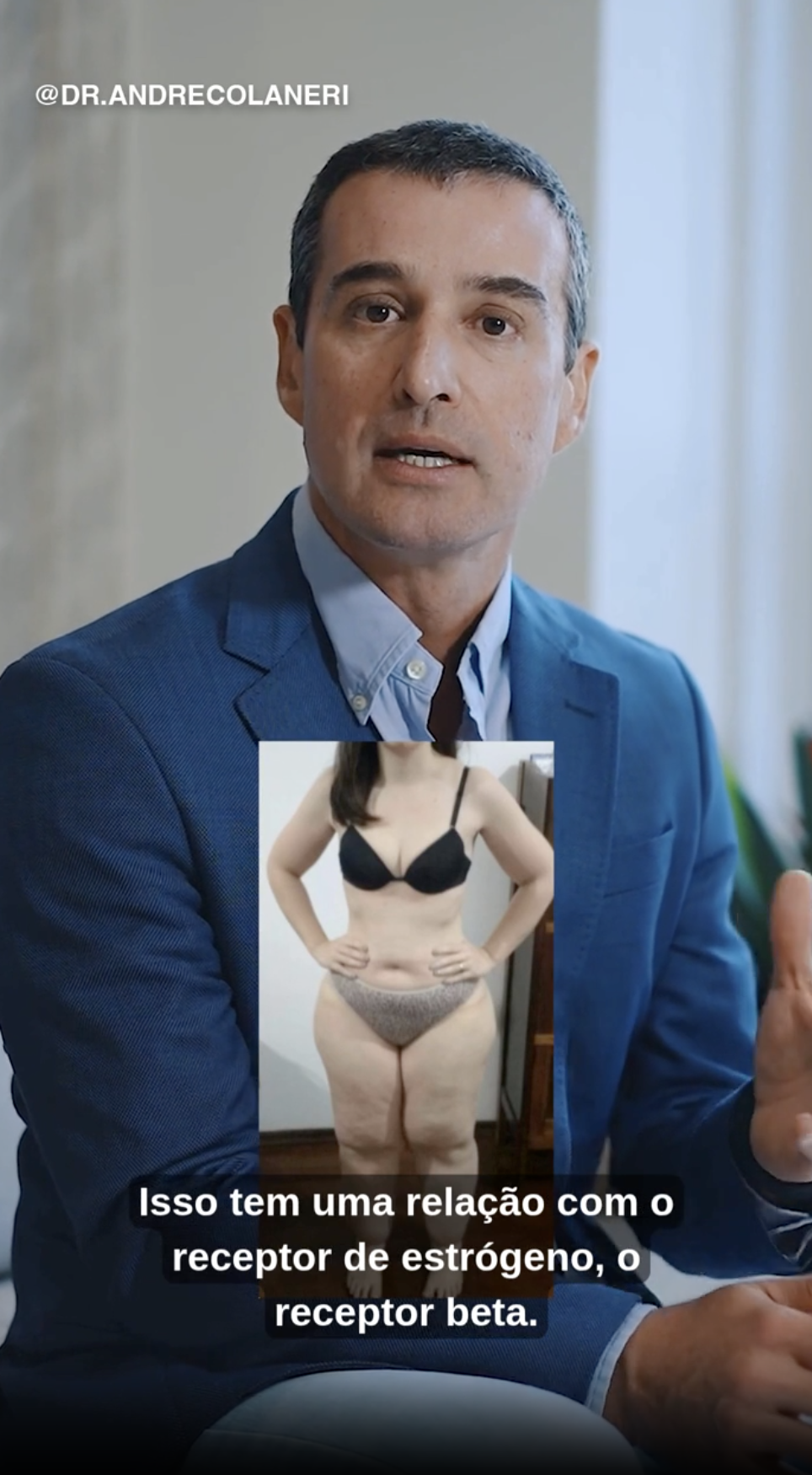 Capa do vídeo Causas do lipedema — Dr. André Colaneri, lipedema em Uberlândia MG