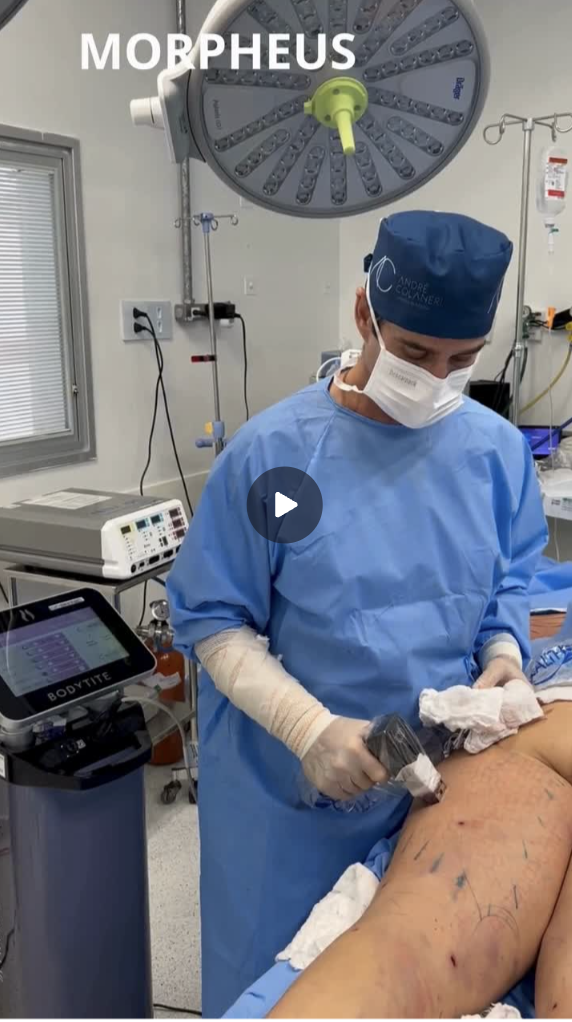 Capa do vídeo Morpheus — Dr. André Colaneri, lipedema em Uberlândia MG
