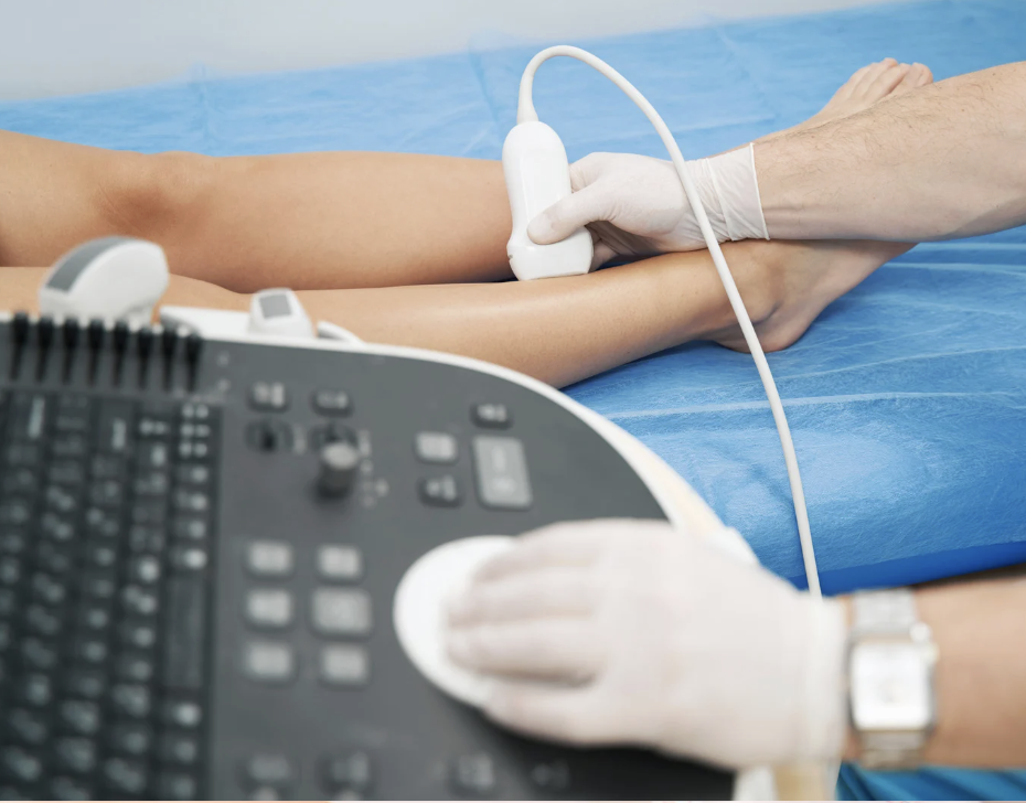 Ultrassom vascular da perna para avaliação de varizes e linfedema