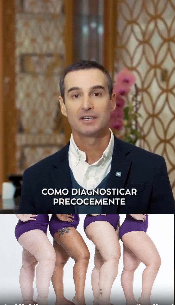 Capa do vídeo Como diagnosticar o lipedema — Dr. André Colaneri, lipedema em Uberlândia MG